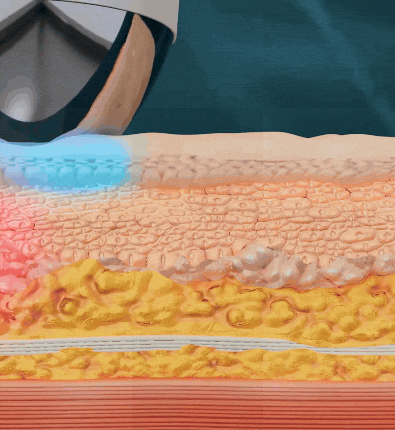 POINT 3. 빠르고 정밀한 에너지